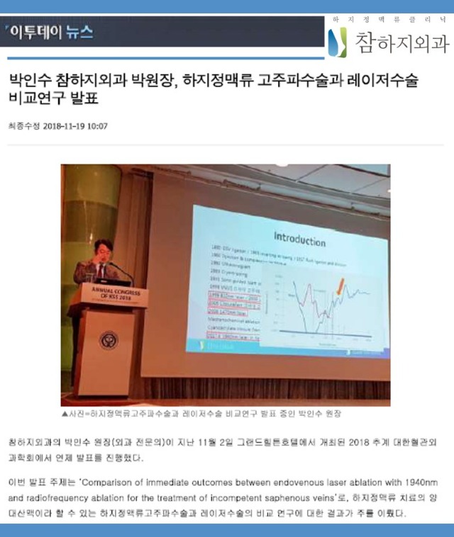 181119이투데이하지정맥류레이저.jpg