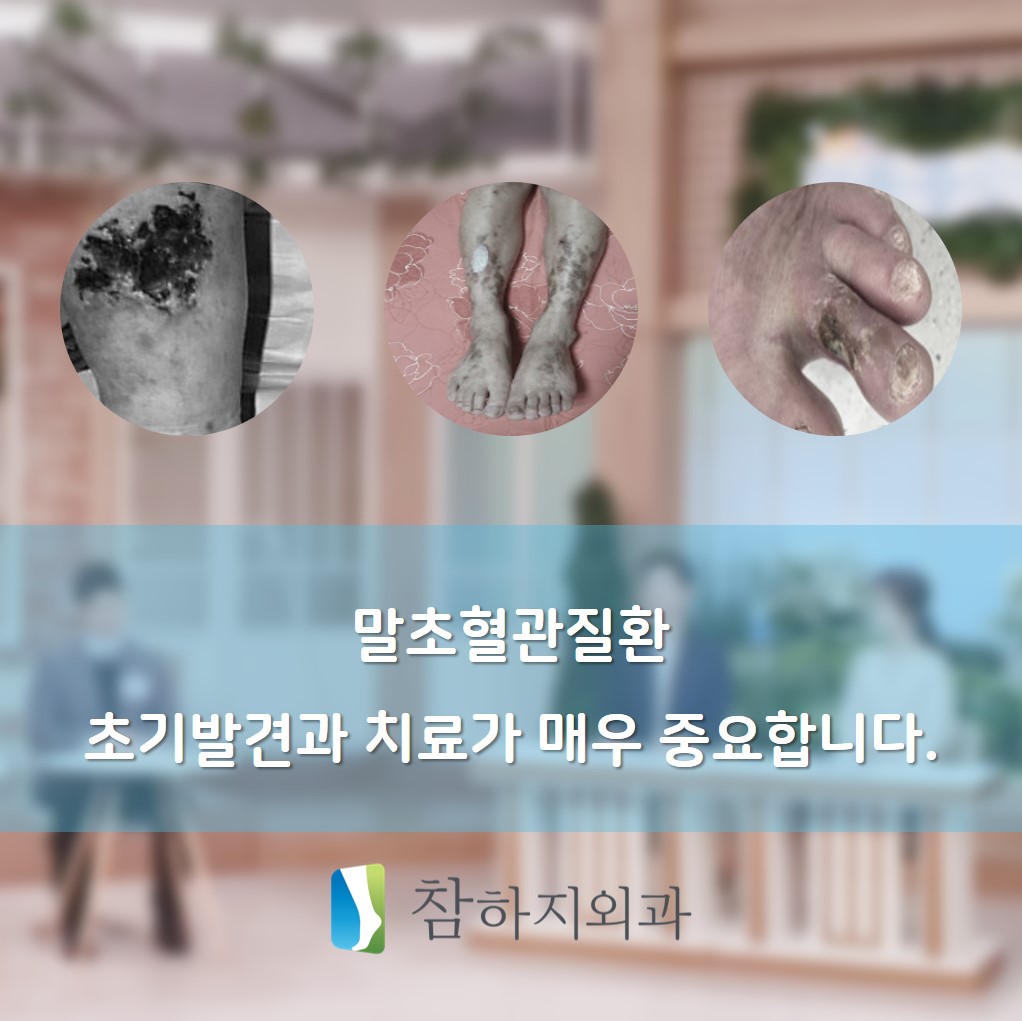 혈관 기분좋은날 말초혈관질환 말초동맥질환 참하지외과 김대환원장.jpg