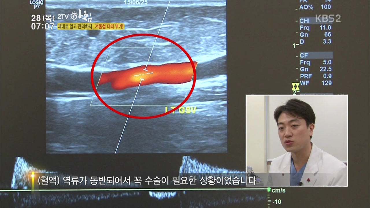 160128 2TV 아침 2부 생홀의 신.mp4_000122663.jpg