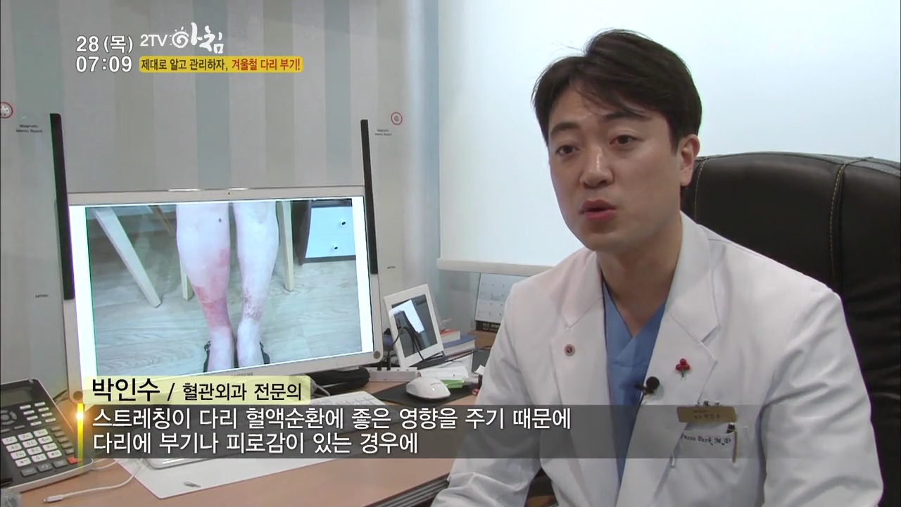 160128 2TV 아침 2부 생홀의 신.mp4_000208765.jpg