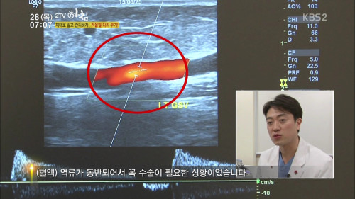 160128 2TV 아침 2부 생홀의 신.mp4_000122663.jpg