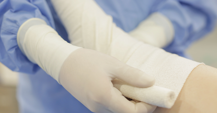 발거술 하지정맥류의 치료