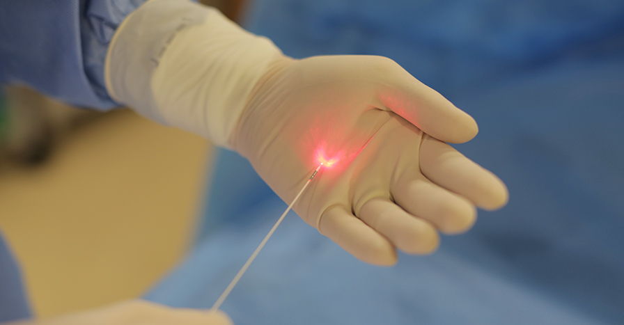 레이저수술 하지정맥류의 치료