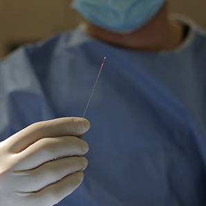 레이저수술 하지정맥류의 치료