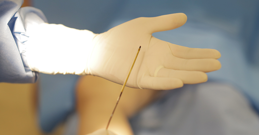 고주파수술 하지정맥류의 치료