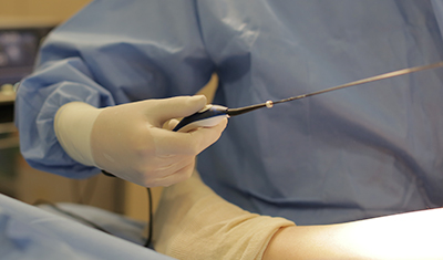 고주파수술 하지정맥류의 치료