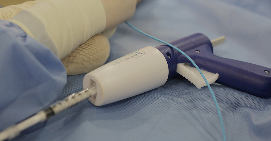 베나실 하지정맥류의 치료