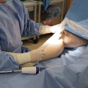 베나실 하지정맥류의 치료