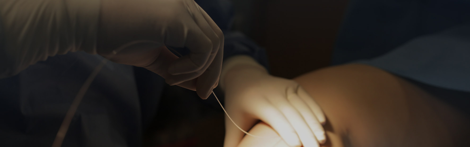 베나실 하지정맥류의 치료