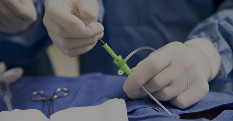 클라리베인 · 플레보그립 하지정맥류의 치료