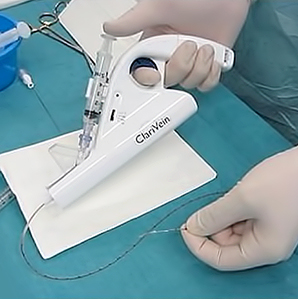 클라리베인 · 플레보그립 하지정맥류의 치료