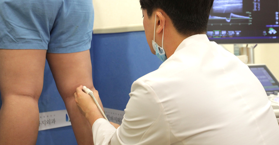 혈관경화요법 하지정맥류의 치료