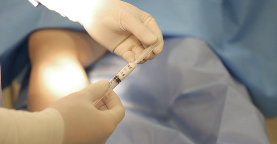 혈관경화요법 하지정맥류의 치료