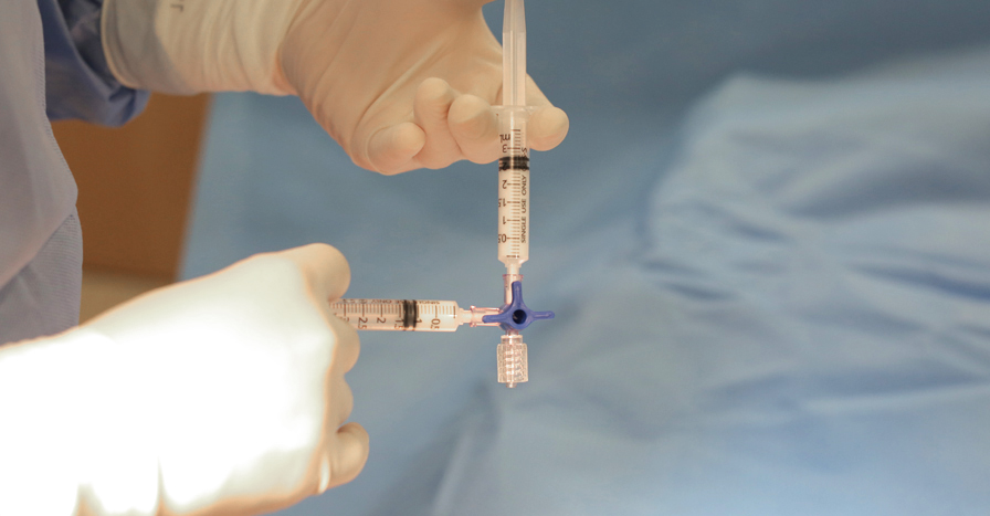 혈관경화요법 하지정맥류의 치료