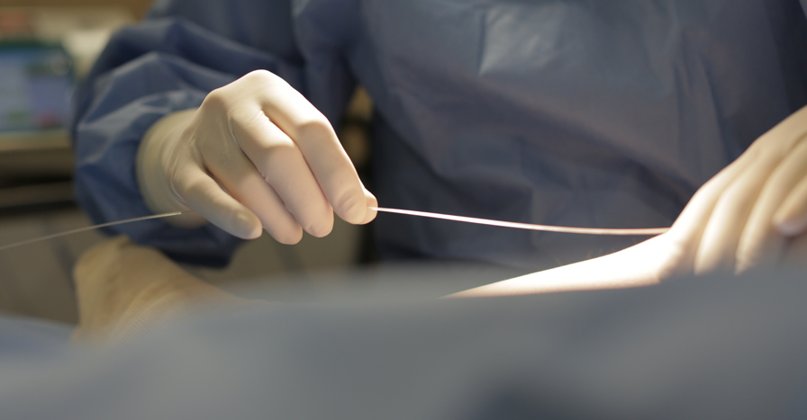 정맥류제거술 하지정맥류의 치료