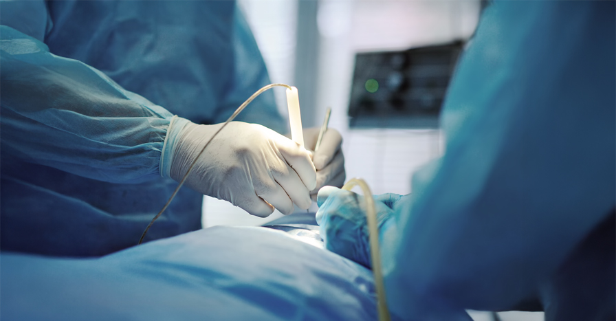 정맥류제거술 하지정맥류의 치료