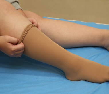 보존적치료 하지정맥류의 치료