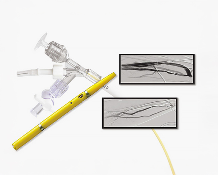 엔지오젯 투석혈관