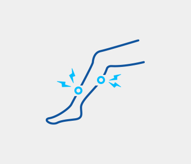 하지정맥류의 증상 하지정맥류