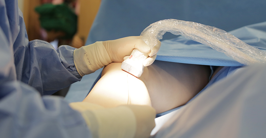 하지정맥류의 검사 하지정맥류