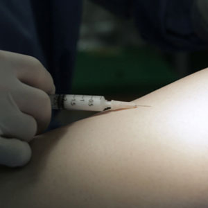 치료방법 하지정맥류의 치료