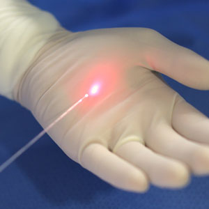 치료방법 하지정맥류의 치료