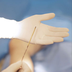 치료방법 하지정맥류의 치료