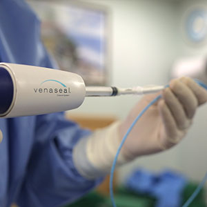 치료방법 하지정맥류의 치료