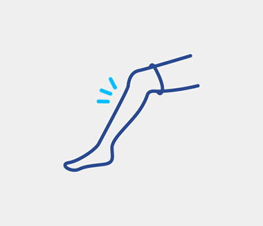 치료방법 하지정맥류의 치료