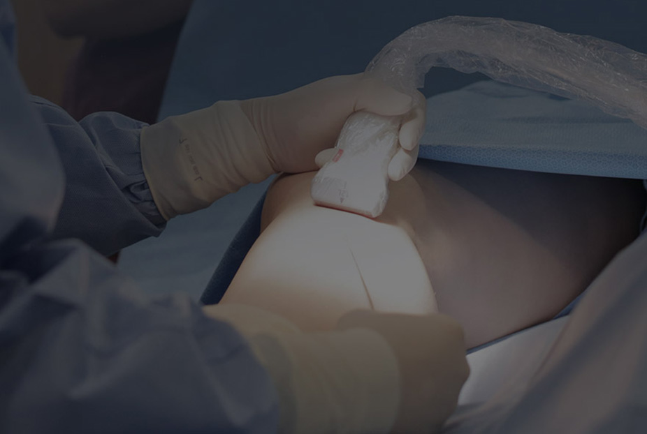 치료방법 하지정맥류의 치료